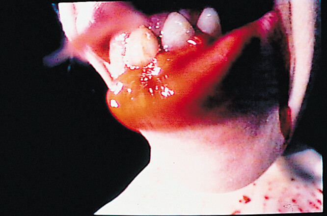 © Courtesy de l’artiste. Collection IAC